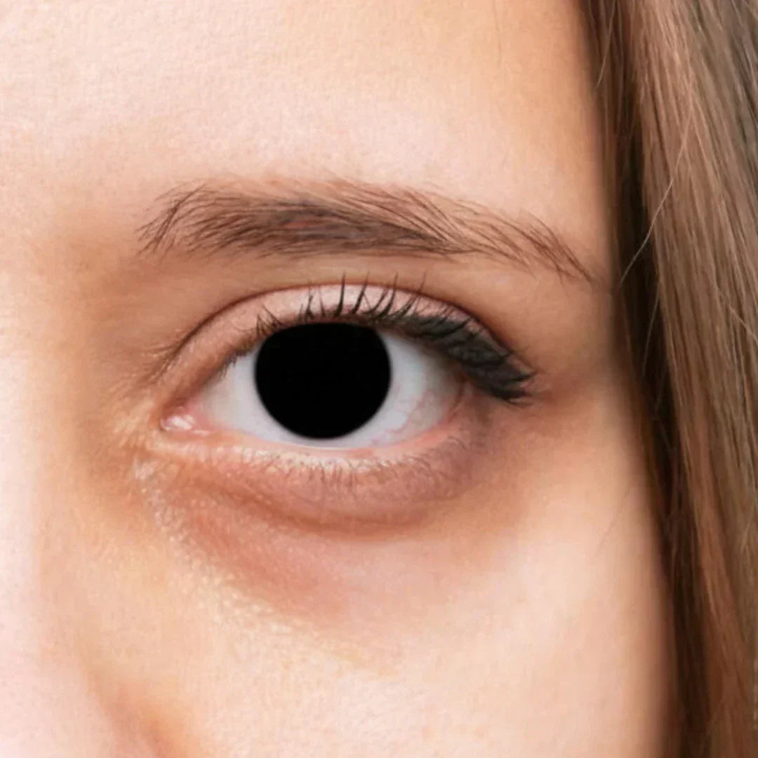 Dark Circles Under Eyes? Ayurveda Explains the Root Cause — And How to Reduce Them Naturally